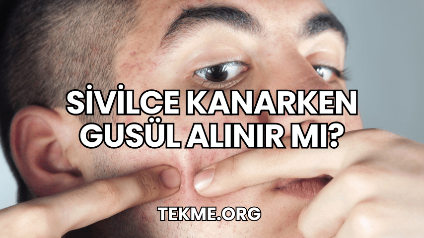 Sivilce Kanarken Gusül Alınır Mı?