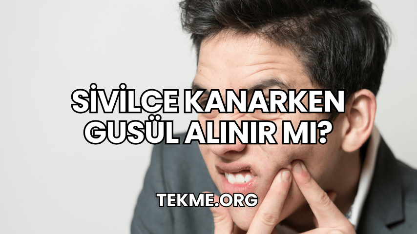 Sivilce Kanarken Gusül Alınır Mı?