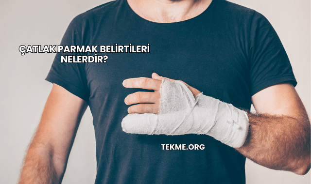 Çatlak Parmak Belirtileri Nelerdir?