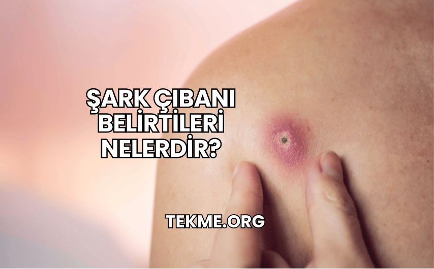 Şark Çıbanı Belirtileri Nelerdir?