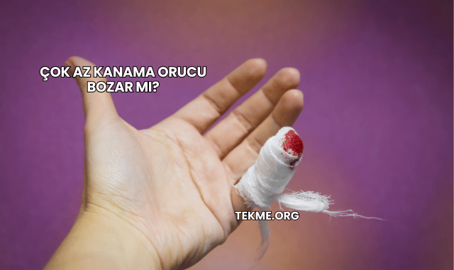 Çok Az Kanama Orucu Bozar mı?