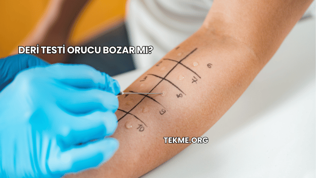 Deri Testi Orucu Bozar mı?