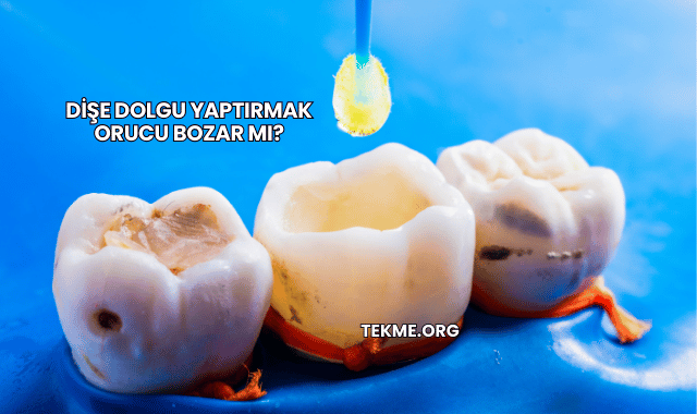 Dişe Dolgu Yaptırmak Orucu Bozar mı?