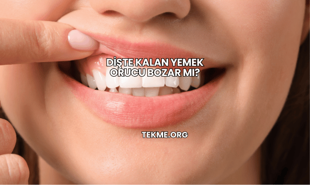 Dişte Kalan Yemek Orucu Bozar mı?