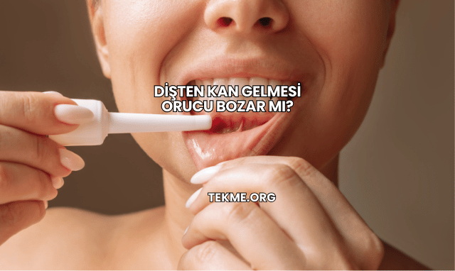 Dişten Kan Gelmesi Orucu Bozar mı?