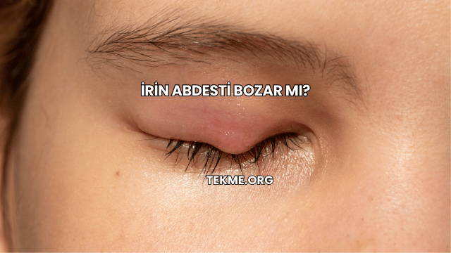 İrin Abdesti Bozar mı?